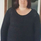 Compare Before & After Photos of _procedure_photos.phpGastric Band Surgery