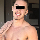 Compare Before & After Photos of _procedure_photos.phpSex Reassignment Surgery (Female To Male)