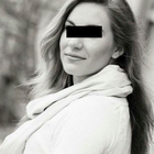 Compare Before & After Photos of _procedure_photos.phpSex Reassignment Surgery (Female To Male)