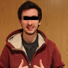 Compare Before & After Photos of _procedure_photos.phpSex Reassignment Surgery (Female To Male)