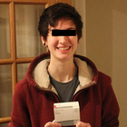 Compare Before & After Photos of _procedure_photos.phpSex Reassignment Surgery (Female To Male)