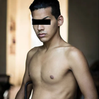 Compare Before & After Photos of _procedure_photos.phpSex Reassignment Surgery (Female To Male)