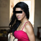 Compare Before & After Photos of _procedure_photos.phpSex Reassignment Surgery (Female To Male)