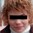 Compare Before & After Photos of _procedure_photos.phpSex Reassignment Surgery (Female To Male)