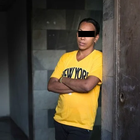 Compare Before & After Photos of _procedure_photos.phpSex Reassignment Surgery (Female To Male)