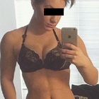 Compare Before & After Photos of _procedure_photos.phpSex Reassignment Surgery (Female To Male)