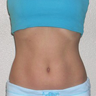 Compare Before & After Photos of _procedure_photos.phpMesotherapy