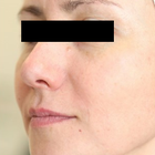 Compare Before & After Photos of _procedure_photos.phpStem Cell Therapy