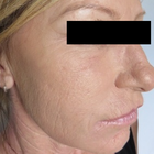 Compare Before & After Photos of _procedure_photos.phpStem Cell Therapy