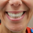 Compare Before & After Photos of _procedure_photos.phpInvisalign