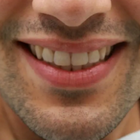 Compare Before & After Photos of _procedure_photos.phpInvisalign