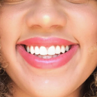 Compare Before & After Photos of _procedure_photos.phpBraces