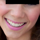 Compare Before & After Photos of _procedure_photos.phpBraces