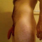 Compare Before & After Photos of _procedure_photos.phpPenis Augmentation