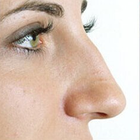 Compare Before & After Photos of _procedure_photos.phpNose Surgery