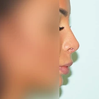 Compare Before & After Photos of _procedure_photos.phpNose Surgery