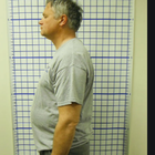 Compare Before & After Photos of _procedure_photos.phpChiropractic Treatment