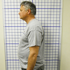 Compare Before & After Photos of _procedure_photos.phpChiropractic Treatment