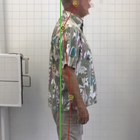 Compare Before & After Photos of _procedure_photos.phpChiropractic Treatment