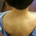 Compare Before & After Photos of _procedure_photos.phpChiropractic Treatment