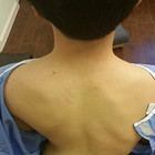 Compare Before & After Photos of _procedure_photos.phpChiropractic Treatment