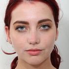 Compare Before & After Photos of _procedure_photos.phpRhinoplasty