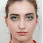 Compare Before & After Photos of _procedure_photos.phpRhinoplasty