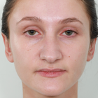 Compare Before & After Photos of _procedure_photos.phpRhinoplasty