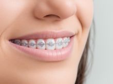 Search and Compare the Best Clinics and Doctors at the Lowest Prices for Braces in Philippines