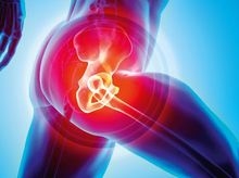 Search and Compare the Best Clinics and Doctors at the Lowest Prices for Hip Surgery in Germany
