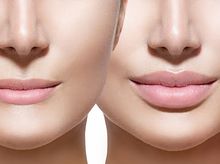 Search and Compare the Best Clinics and Doctors at the Lowest Prices for Lip Reduction in Vietnam