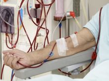 Search and Compare the Best Clinics and Doctors at the Lowest Prices for Arteriovenous (AV) Fistula for Dialysis in Philippines