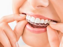 Search and Compare the Best Clinics and Doctors at the Lowest Prices for Invisalign in Thailand