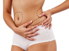Search and Compare the Best Clinics and Doctors at the Lowest Prices for Tummy Liposuction in Vietnam