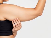 Bandingkan Harga, Biaya & Ulasan untuk Arm Liposuction di Jakarta