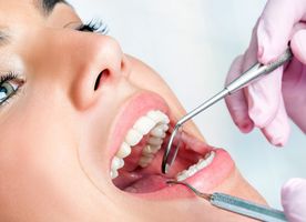 Kiểm tra răng