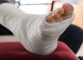 Ankle Surgery