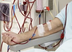 Đường rò động mạch (AV) để lọc máu