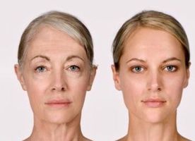 Anti-Aging Stem Cell Treatment