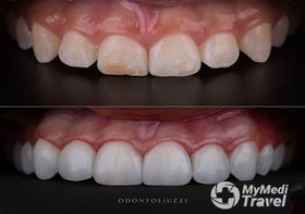 Odontoliuzzi Brazilian Dental Clinic with Excellence