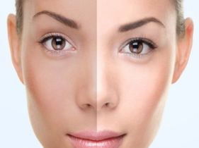 Search and Compare the Best Clinics and Doctors at the Lowest Prices for Skin Lightening in Philippines