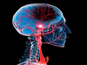 Search and Compare the Best Clinics and Doctors at the Lowest Prices for Brain Aneurysm Repair in Vietnam