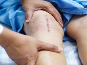 Search and Compare the Best Clinics and Doctors at the Lowest Prices for Knee Arthroplasty in Nghe An