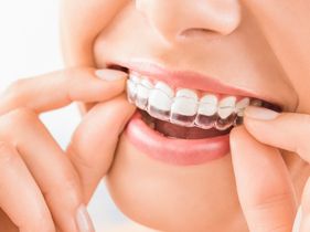 Search and Compare the Best Clinics and Doctors at the Lowest Prices for Invisalign in Philippines