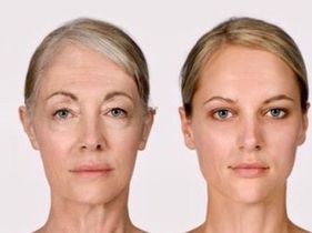 Bandingkan Harga, Biaya & Ulasan untuk Perawatan Anti-Aging Stem Cell di Bali