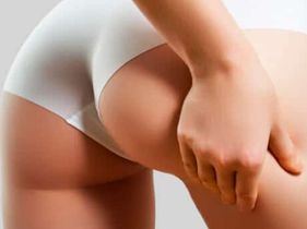 Search and Compare the Best Clinics and Doctors at the Lowest Prices for Buttock Liposuction in Thailand