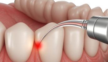 Search and Compare the Best Clinics and Doctors at the Lowest Prices for Laser Treatment for Gum Disease in Bogota