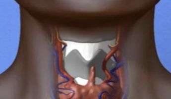 Compare Prices, Costs & Reviews for Laryngeal Surgery in Al Wosta