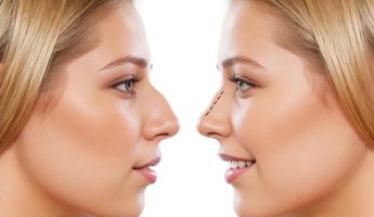 Search and Compare the Best Clinics and Doctors at the Lowest Prices for Septoplasty in Dyfed