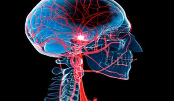 Compare Prices, Costs & Reviews for Brain Aneurysm Repair in Vietnam